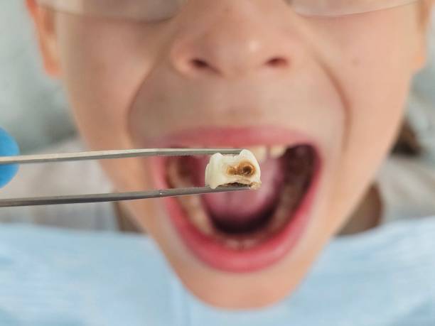 Best Emergency Dental Care for Sports Injuries in Claypool Hill, VA