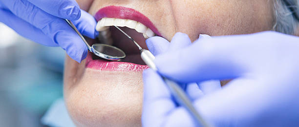 Best Dental Abscess Treatment in Claypool Hill, VA